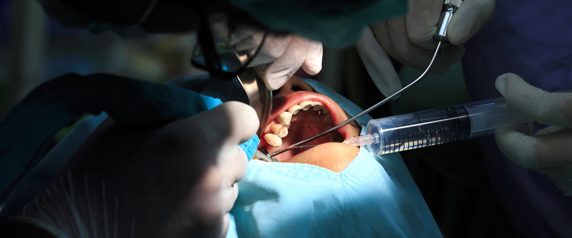 What is Dental Surgery and How Can It Improve Your Smile?
